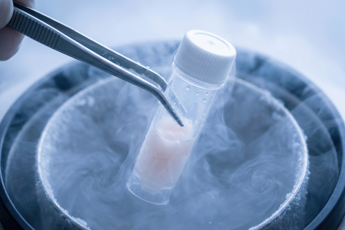 Tailoring a DMA-based cryopreservation protocol with anti-freeze (glycol)proteins for commercial and native breeds of chicken